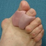 Ortesis de silicona para pies a medida